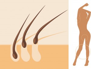 CHIRURGIE ESTHÉTIQUE ÉPILATION