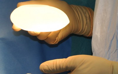 Quand doit on changer des implants en gel de silicone?