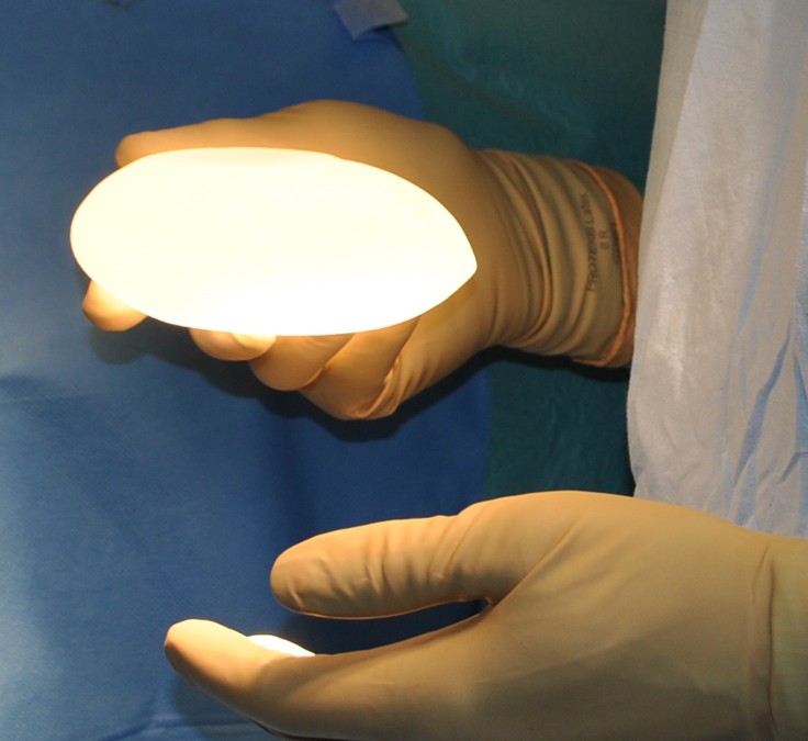 Quand doit on changer des implants en gel de silicone?