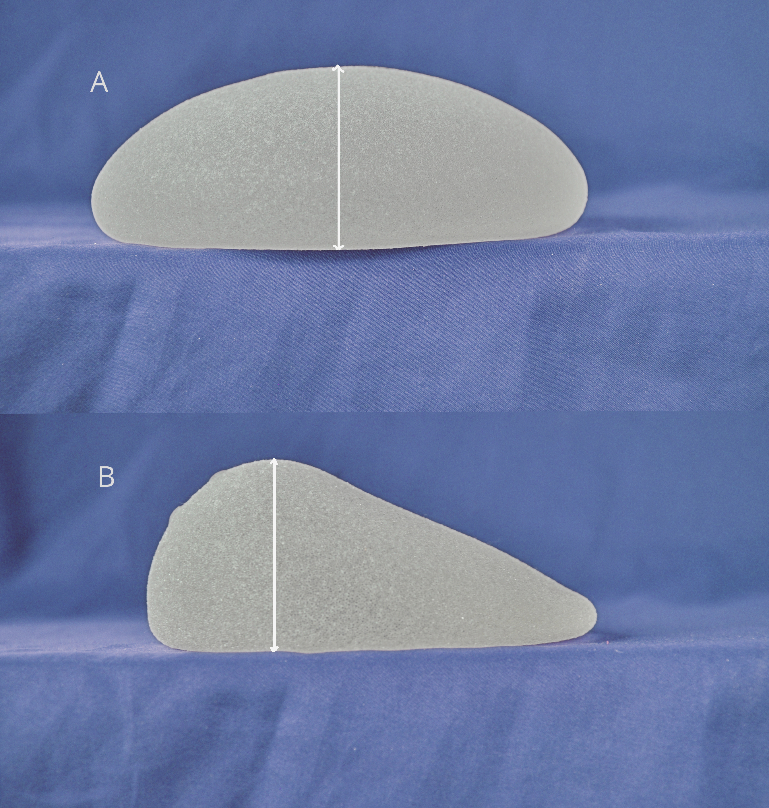 C'est la forme du sein initial qui conduit à utiliser un implant anatomique implant anatomique naturel