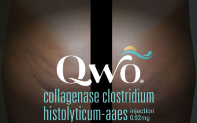 Qwo:La fin de la cellulite sur les fesses ?