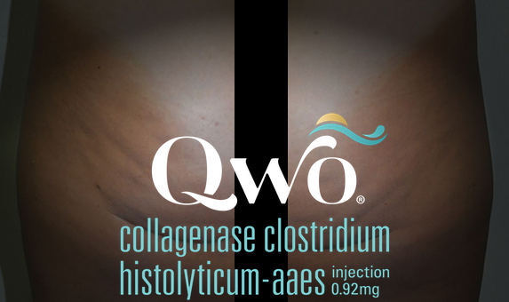 qwo injection cellulite fesses